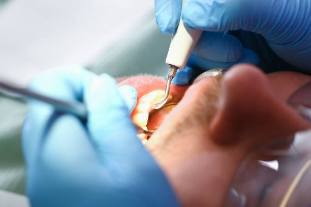 Best Emergency Dental Care for Broken or Chipped Teeth in Sells, AZ